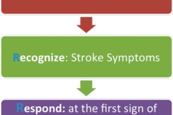 Strokes – Preventable, Treatable And Survivable