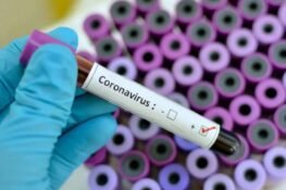 10 More COVID-19 Deaths As 238 New Cases Take Nigeria’s Total To 2170