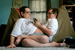 World’s Oldest Conjoined Twins Die At 68